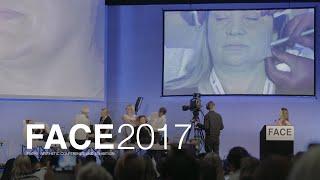 FACE Conference and Exhibition 2017