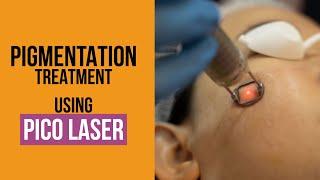 PICO LASER FOR SKIN PIGMENTATION | AlKhaleej DHA Clinic