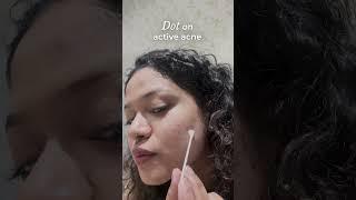 Overnight Acne Spot Corrector || How to Use