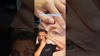 SAGGING UPPER EYELIDS  Dr. Daria Hamrah