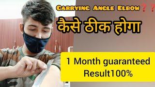 What is Carrying Angle Elbow || How to fix the prblm in 1 month || Army Lovers Motivational lines