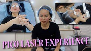 PICO Laser Treatment | Before & After