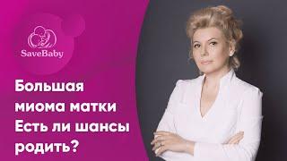 Большая миома матки. Есть ли шансы родить? Акушер-гинеколог