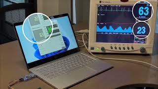 Seeed Studio 60GHz Radar heartbeat, breathing comparison test with medical ECG & Apple watch