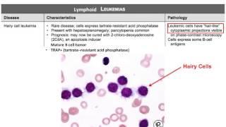 USMLE® Step 1 High Yield: Oncology: Leukemia