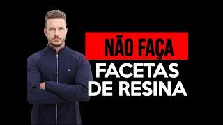 NÃO FAÇA FACETAS DE RESINA