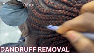 ASMR: RAW DANDRUFF REMOVAL & SCALP CHECK ON COLLEAGUE’S HEAD AT THE OFFICE/ NO MIC (office tools)