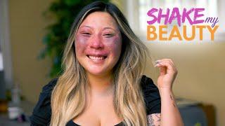 Revealing My Birthmark On A Date | SHAKE MY BEAUTY