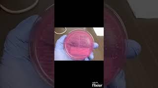 Escherichia coli  (E. coli) on MacConkey agar (MAC) - Clinical Microbiology #shorts