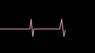 Heartbeat overlay