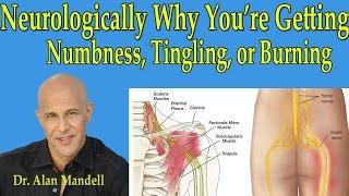 Neurologically Why You're Getting Numbness,Tingling, or Burning in Arms or Legs - Dr Mandell