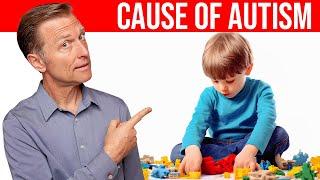 The REAL Cause of Autism Revealed: Dr. Berg Explains