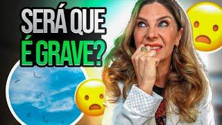 Moscas Volantes no Olho - Causas Graves