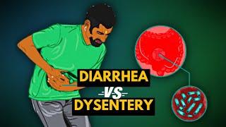 Differences between Diarrhea and Dysentery...