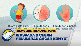 Newsline Trending Topic - Waspada & Cegah Penularan Cacar Monyet