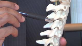 Cervical Endoscopic Decompression Overview - Dr. Anuj Prasher | South Florida Orthopaedics