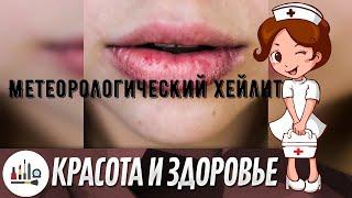 Метеорологический хейлит