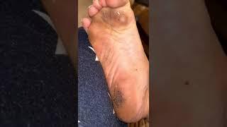 Dirty feet soles fetish compilation #feet #dirtyfeet #feetlover #dirtyfeetsoles