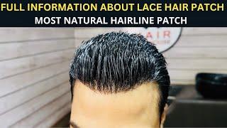 Premium Lace Hair Patch | Full Information About Frontlace Hair patch | Hair wig house