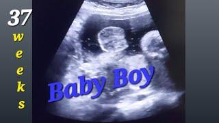 9 month pregnancy ultrasound | 37 week scan | Posterior Placenta | Baby Boy or Girl | Baby heartbeat