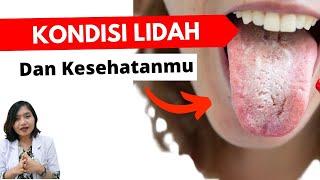 9 Diseases Visible on the TONGUE | Dr. Emasuperr
