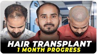 Hair Transplant in Kolkata | Best Results & Cost of Hair Transplant in Kolkata