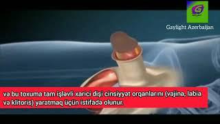 Cinsiyyət Orqanı Dəyişdirmə Əməliyyatı | Penisdən Vaginaya Dəyişdirmə