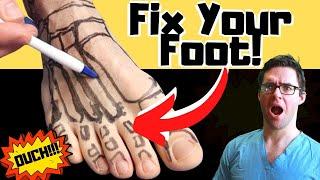 Broken Foot Recovery & Foot Fracture Home Treatments [Top 25 Hacks]