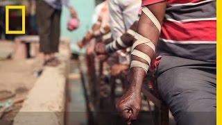 WATCH: The Practice of Bloodletting in New Delhi | National Geographic