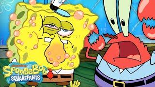 Is SpongeBob Allergic To Krabby Patties?!  "Allergy Attack" Full Scene | SpongeBob