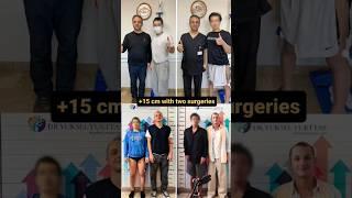 Limb Lengthening in Action: Walking Tall after a 15cm Height Gain #limblengthening