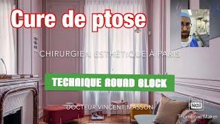 PTOSE ROUND BLOCK AUGMENTATION MAMMAIRE AVANT APRÈS