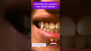 Colmillos de vampiro en resina ‍️ #shorts #vampiro #colmillos #colmillosdevampiro #resina