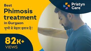 Best Phimosis Treatment in Gurgaon | Laser Circumcision - For FREE Consultation Call On 6366526482