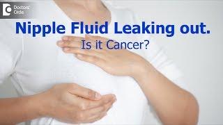 Fluid leaking from the nipples. Is it a sign of breast cancer? - Dr. Nanda Rajneesh| Doctors' Circle