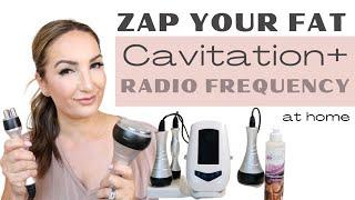 ZAP YOUR FAT with an at home CAVITATION + RADIO FREQUENCY DEVICE that is easy to use!!!