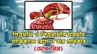 পিত্তথলি ও পিত্তনালীর যাবতীয় সার্জিক্যাল রোগ ও তার প্রতিকার | Gallblader | Dr Mustafizur Rahman