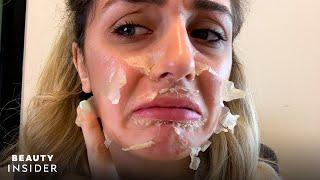 What It’s Like To Get A Chemical Peel For Acne Scars | Beauty Explorers | Beauty Insider