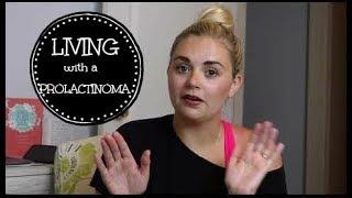 Prolactinoma: Living with a pituitary tumor & how I found out I had a prolactinoma.