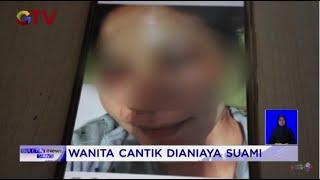 Selebgram di Bandung Alami KDRT, Kasusnya Viral Usai DIunggah di Medsos #BuletiniNewsSiang 03/01