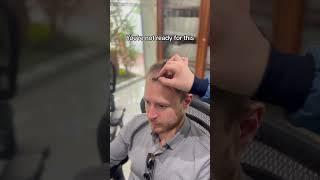 #hairtransplant update #hairtransplantcolombia #bogotahairlines #transplantecapilar