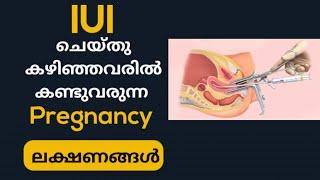 Pregnancy Symptoms after IUI Malayalam