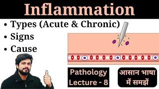 Inflammation Kya Hota Hai | Types - Acute and Chronic | Cause | Signs | Pathology Lecture in Hindi