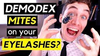 Demodex Mites on Eyelashes? - How to get rid of Demodex Mites