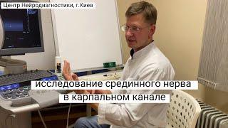 Методика ультразвукового исследования  карпального канала, срединного нерва при туннельном синдроме