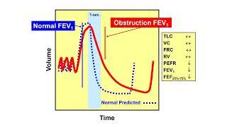 Pulmonary Function Testing - Maximal Expiratory Flow Rates