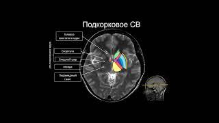 Базовый курс по МРТ  1  Лекция  МР анатомия головного мозга   Лектор  Кротенкова И А