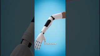 How a Bionic Arm works. #shorts