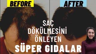 SAÇ DÖKÜLMESİNİ ÖNLEYEN SÜPER BESİNLER | Superfoods to Grow Your Hair  | No Hair Loss