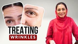 Answering Your Most Asked Questions About Wrinkles | Anti-Aging Tips & Treatments